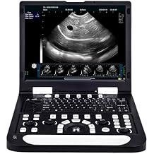 N60 15" LCD Veterinary Ultrasound Machine with PW Function, Carring Bag, Image Video Saving, for Dog Kennels, Cat Feeder, Rabbit Farm Pregnancy Check(7.5 Mhz Linear Array Probe)