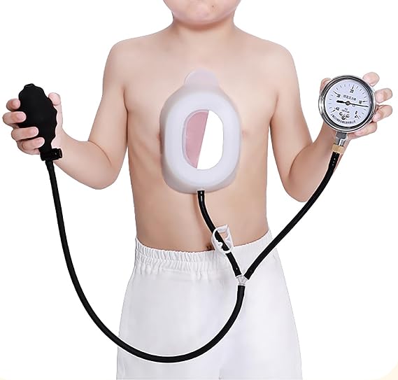 Funnel Chest Orthosis Brace for Pectus Excavatum, Pectus Excavatum Vacuum Bell, Sternal Depression Support for Sunken Chest, for Adults and Child M