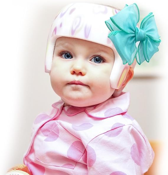 3 Pack Bows for Cranial Helmet Bow Patch Cranial Band Bow Plagiocephaly Helmets Bow