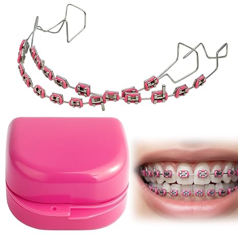 2Pcs Fake Braces Kit, Temporary Tooth Decoration with Metal Wires, Temporary Dental Fake Braces, Teeth Straightening Set with Storage Case, For Dental Students to Practice (Red)