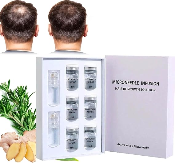 Alphainfuse Hair Regrowth System,Microneedle Infusion Hair Regrowth Solution,Hair Regrowth Treatment Serum,Painless Micro-Infusion Technology for Hair Growth,Makes Hair Thicker and Healthier (Set B)